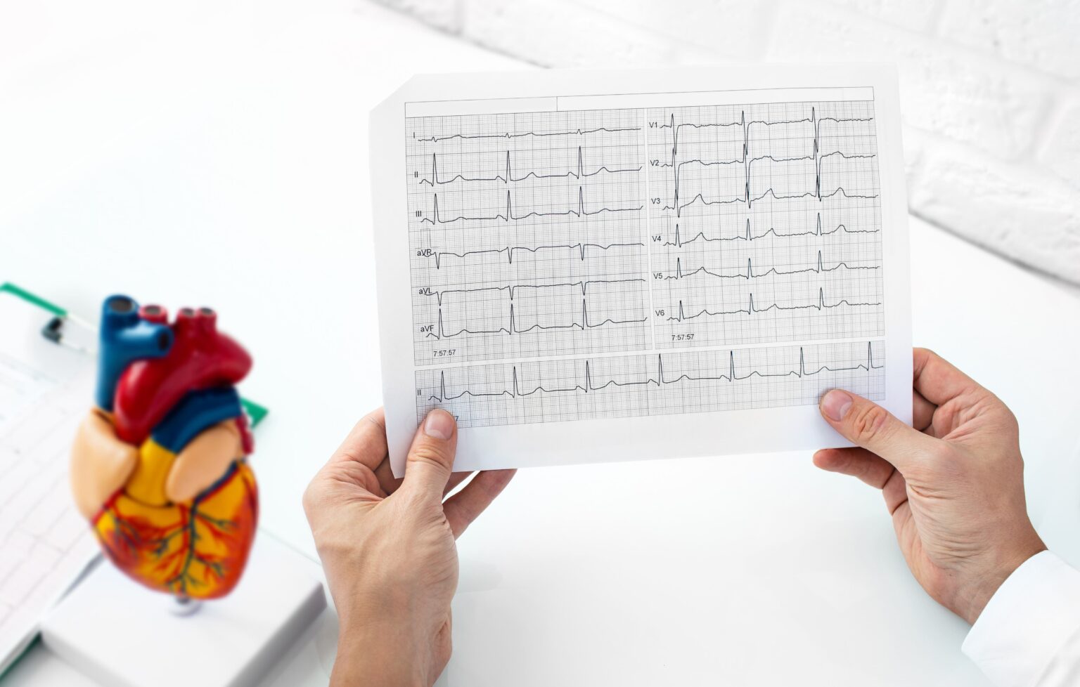 Image Carrington irregular heartbeat