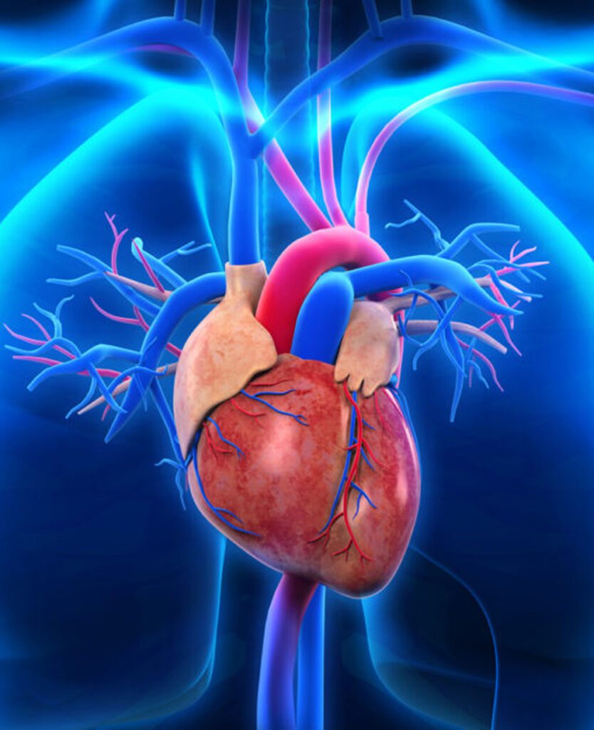 Coronary Artery Disease